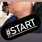 کلینیک زیبایی آیشن