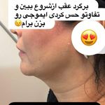 کلینیک زیبایی آیشن