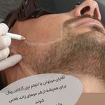 مرکز لیزر ،پوست و زیبایی کندی بیوتی
