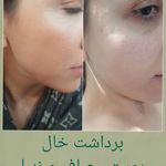 پدیکور و پودولوژیSD