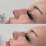 کلینیک پوست و زیبایی ژیلاوَش