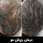کلینیک تخصصی زیبایی رز - فیلر بوتاکس