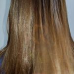 کراتین و احیا تخصصی غزال رحیمی