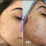 خدمات فیشال تخصصی هدیه جعفرزاده