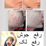 مرکز لیزر و کلینیک زیبایی آسمان پرند