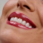 مطب دندانپزشکی زیبایی دکتر مانديس صدر