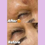 مرکز تخصصی فیشال و پاکسازی پوست حنانه
