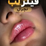 کلینیک زیبایی رز سفید