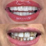 کلینیک‌دندانپزشکی دنتال آرنا-بیمه نیستیم