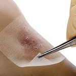 علی شیری کارشناس تخصصی زخم