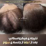 مرکز تخصصی میکرواسکالپ سر پریسا رجبی