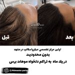 مرکز تخصصی میکرواسکالپ سر پریسا رجبی