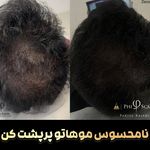 مرکز تخصصی میکرواسکالپ سر پریسا رجبی