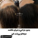 مرکز تخصصی میکرواسکالپ سر پریسا رجبی