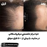 مرکز تخصصی میکرواسکالپ سر پریسا رجبی