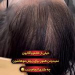 مرکز تخصصی میکرواسکالپ سر پریسا رجبی