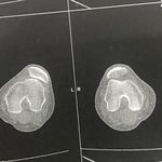 مطب دکتر بانصیری متخصص ارتوپدی و فوق تخصص جراحی زانو