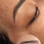 مرکز خدمات و آموزش میکروبلیدینگ رضایی