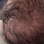 خدمات میکرواسکالپ|اسکالپ کرج|آموزش