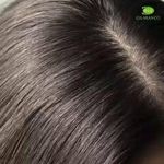 لوسیون ایورمکتین آیوروکا ضد شپش تضمینی