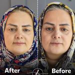 مطب پوست و مو زیبایی دکتر سما