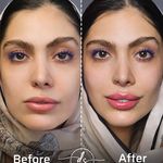 مطب پوست و مو زیبایی دکتر سما