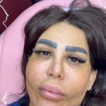 کاشت مژه هیدن ریحانه رجبی