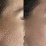 مرکز لیزر موهای زائد ماهور