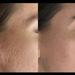 مرکز لیزر موهای زائد ماهور