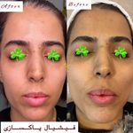 کلینیک پوست و زیبایی ولاغری تاج عظیمیه