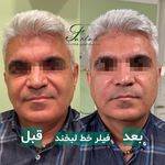 کلینیک زیبایی فرتاک