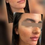 کلینیک پوست،مو،زیبایی و لیزر دالیا