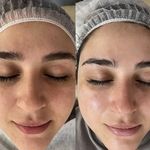 خدمات تخصصی  فیشیال مژگان