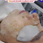 فیشال، پاکسازی و کربوکسی صبا جعفری