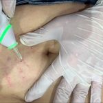 فیشال، پاکسازی و کربوکسی صبا جعفری
