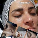 پاکسازی وفیشال اتاق پوست آزیتا