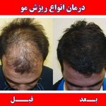 درمان تخصصی انواع عارضه پوست و مو