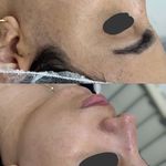 خدمات درماپلنینگ vip با اصلاح ابروی رایگان
