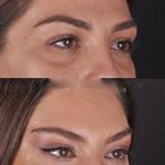 کلینیک زیبایی الماس کاملا اقساطی