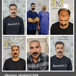 مرکز کاشت مو نیلوفر ( اندیمشک و دزفول )