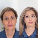عسل بیوتی