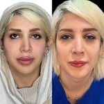 کلینیک زیبایی و لیزر دکتر آزاده اسماعیلی