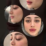 مرکز لیزر و کلینیک زیبایی دکتر با حجب