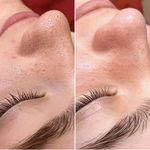 مرکز تخصصی فشیال صورت و اسکراب مو
