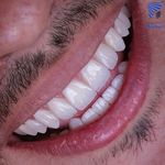 دندانپزشکی پرتو صادقیه از دم قسط با بیمه