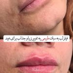 کلینیک تخصصی لیزر و زیبایی شالیزه