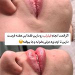کلینیک تخصصی لیزر و زیبایی شالیزه