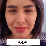 کلینیک تخصصی لیزر و زیبایی شالیزه