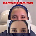 کلینیک تخصصی زیبایی رز - فیلر بوتاکس