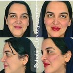 مطب پوست، مو و زیبایی و لیزر شبیرا